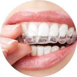 teeth-straightening2