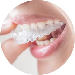 teeth-straightening3